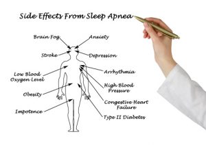 Sleep apnea,